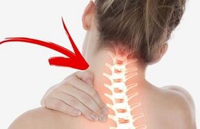 osteochondróza krčnej chrbtice