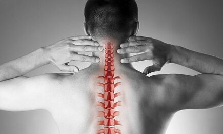 Ako sa prejavuje osteochondróza krčnej chrbtice