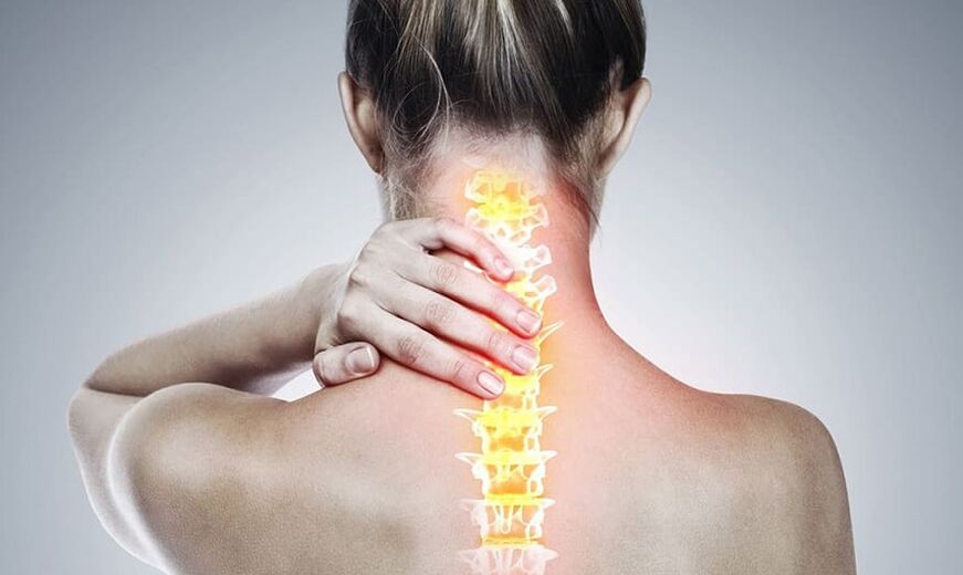 Osteochondróza krčnej chrbtice
