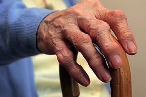 poškodenie prstov s artrózou